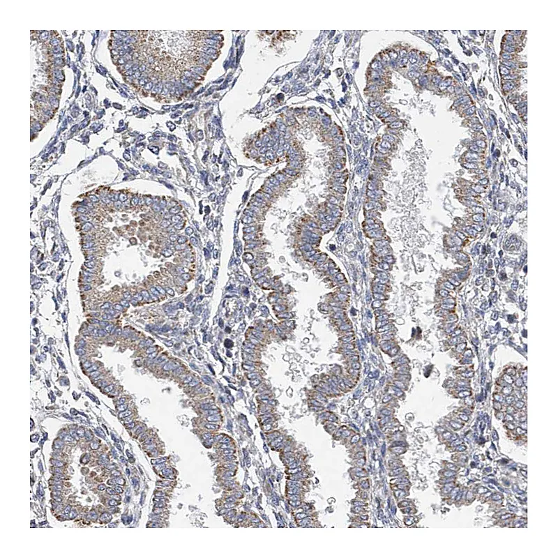 Atlas Antibodies Anti-SLCO4A1 Antibody