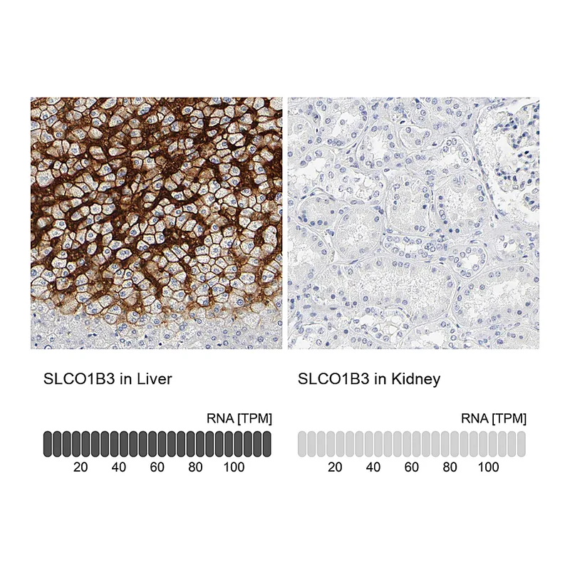 Atlas Antibodies Anti-SLCO1B3 Antibody