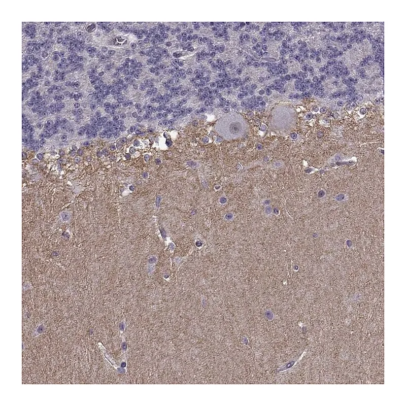 Atlas Antibodies Anti-SLCO3A1 Antibody