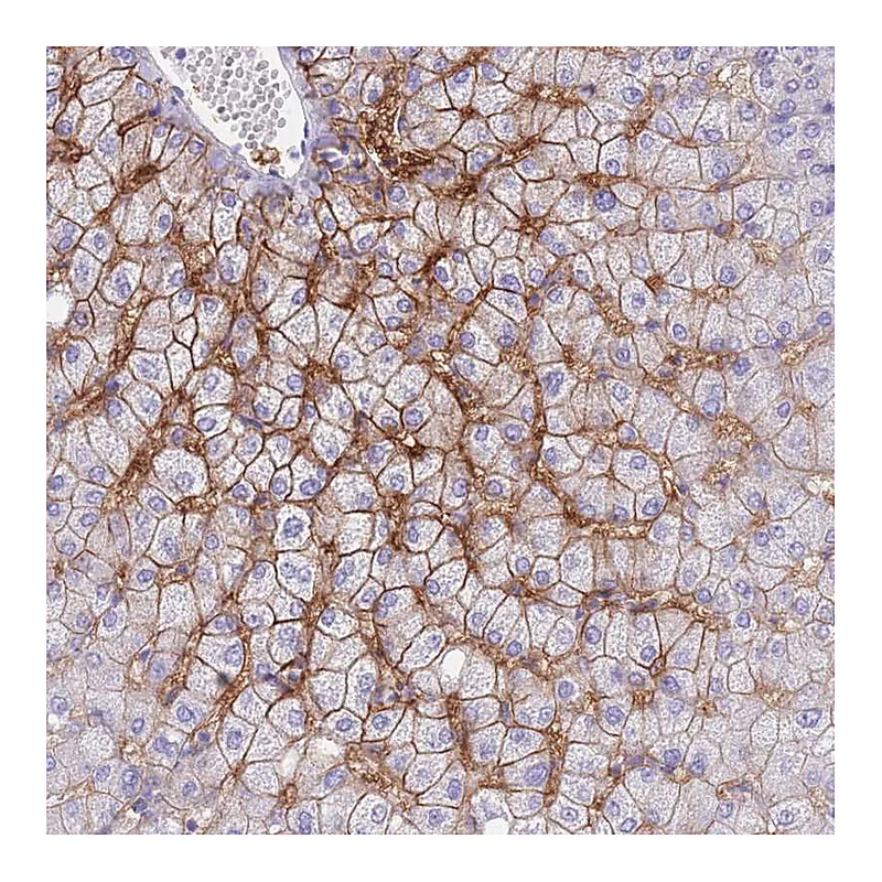 Atlas Antibodies Anti-SLCO1B3 Antibody