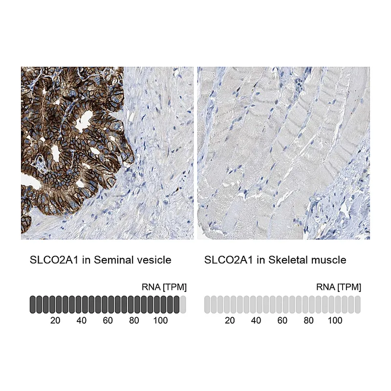 Atlas Antibodies Anti-SLCO2A1 Antibody