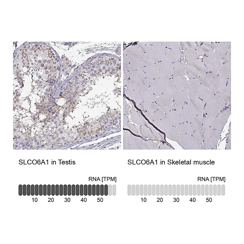 Atlas Antibodies Anti-SLCO6A1 Antibody