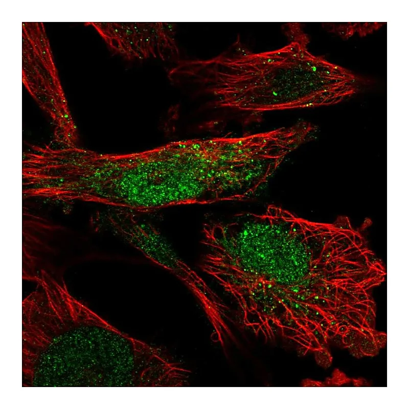 Atlas Antibodies Anti-SLF2 Antibody