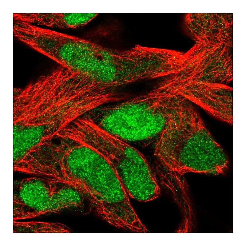 Atlas Antibodies Anti-SLFN11 Antibody