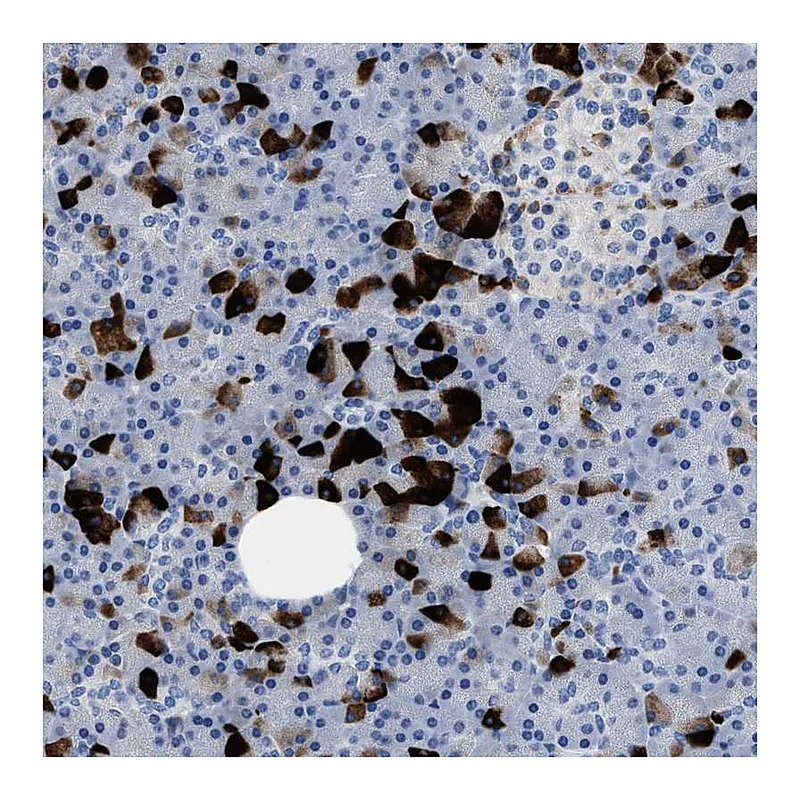 Atlas Antibodies Anti-SLFN13 Antibody