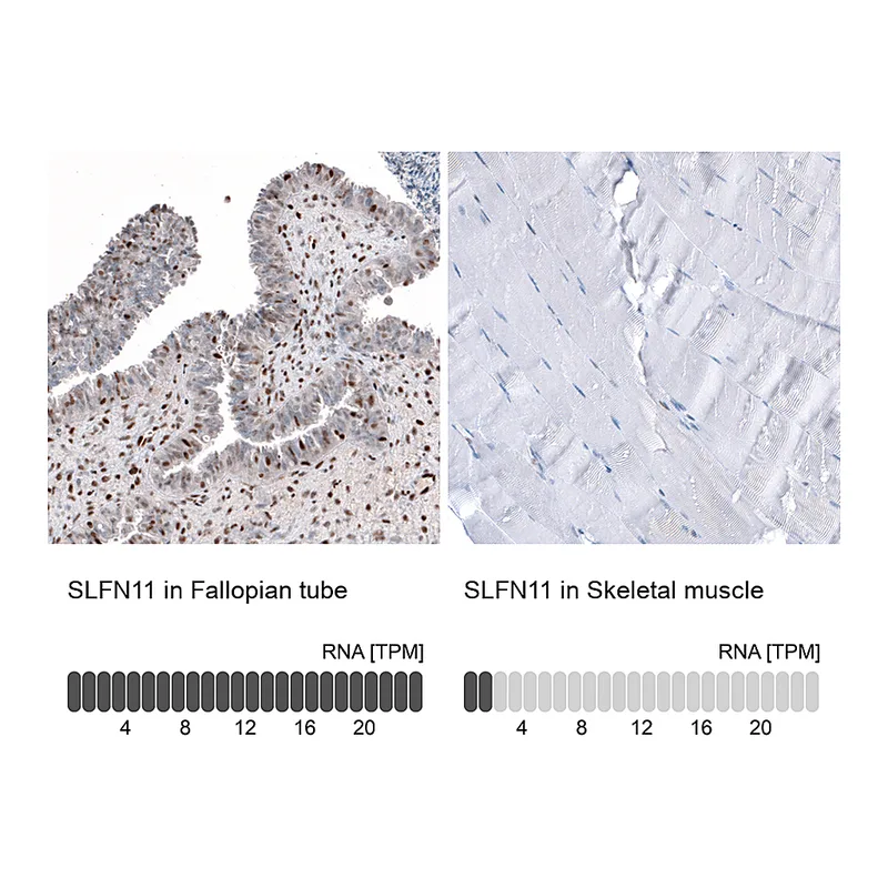 Atlas Antibodies Anti-SLFN11 Antibody