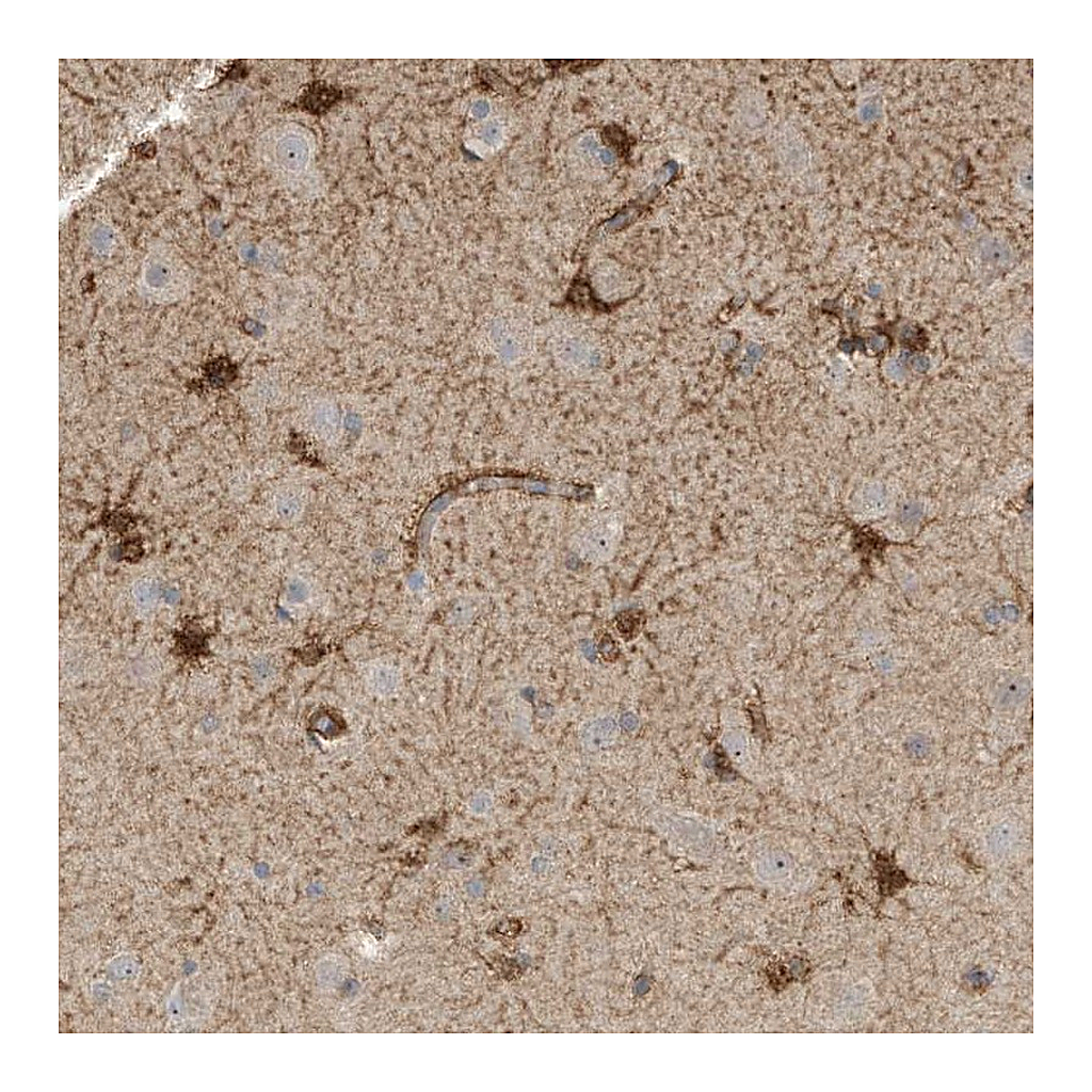 Atlas Antibodies Anti-SLFN14 Antibody