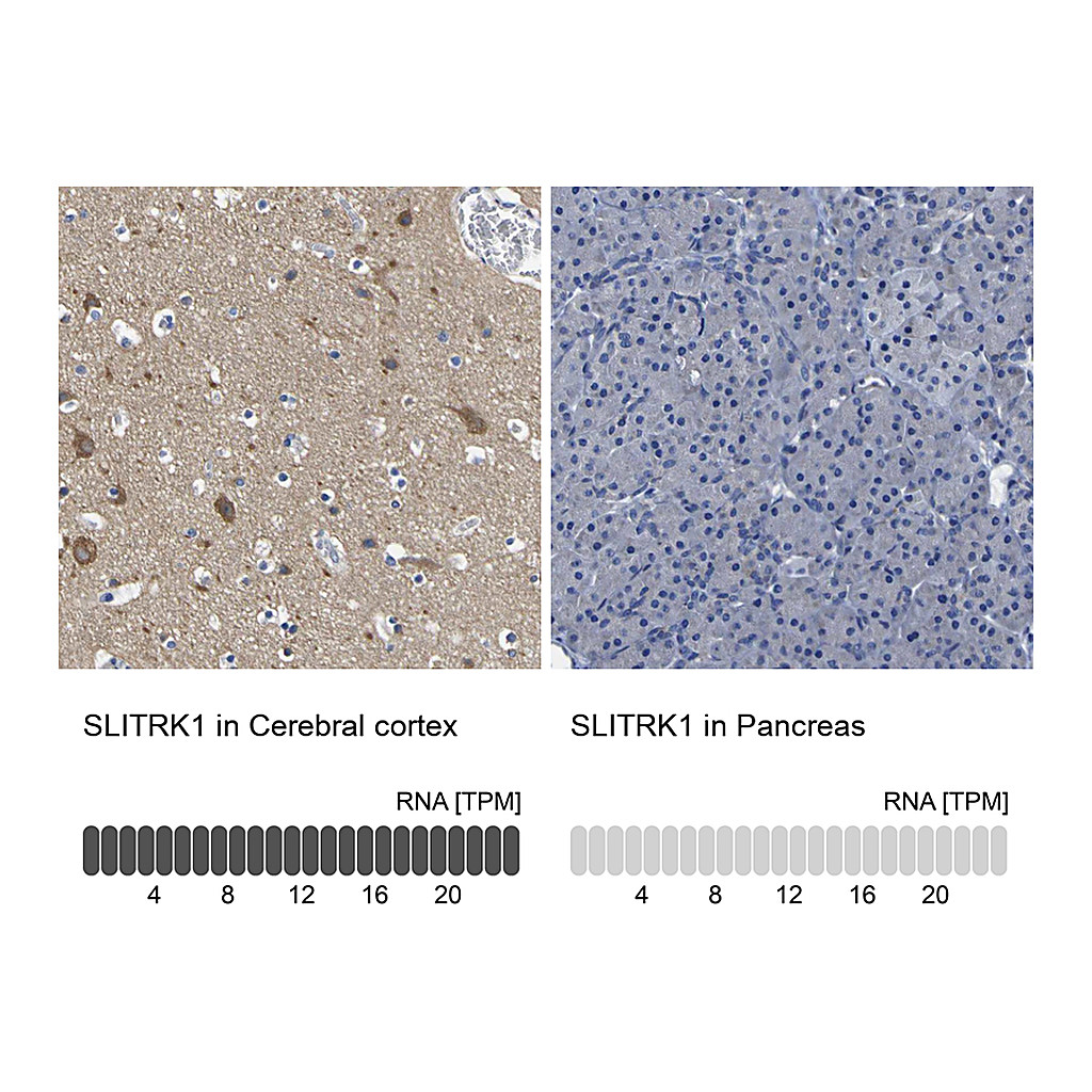 Atlas Antibodies Anti-SLITRK1 Antibody