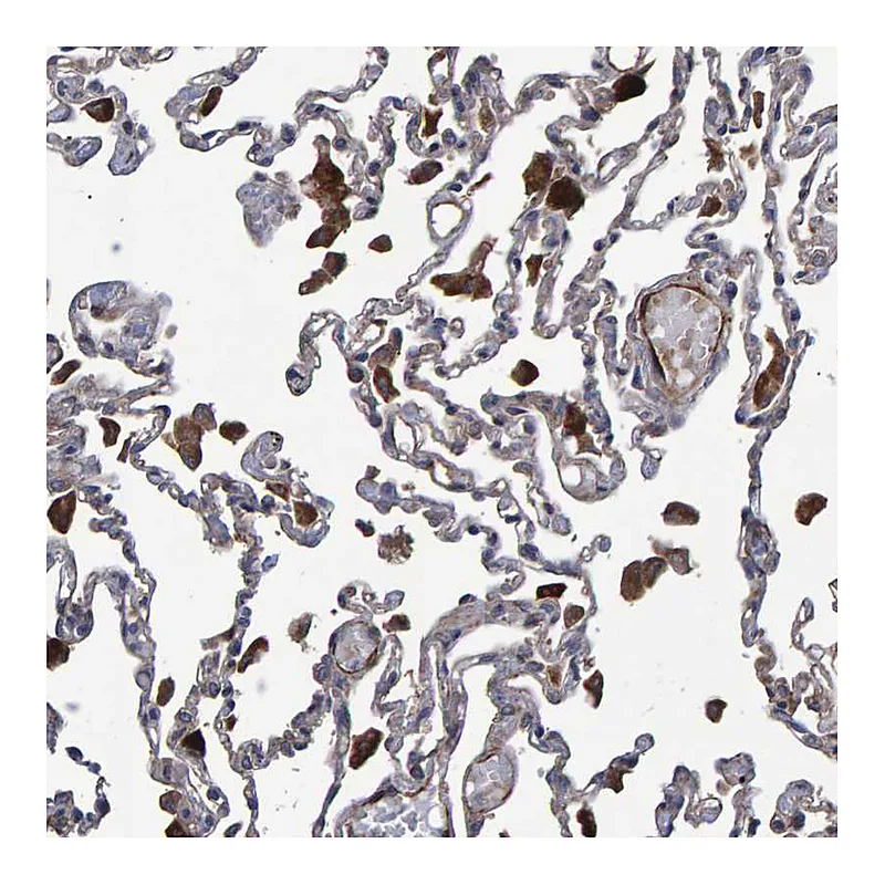 Atlas Antibodies Anti-SLIT2 Antibody