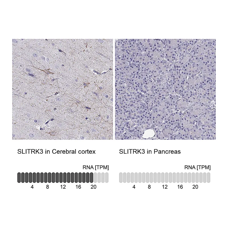 Atlas Antibodies Anti-SLITRK3 Antibody