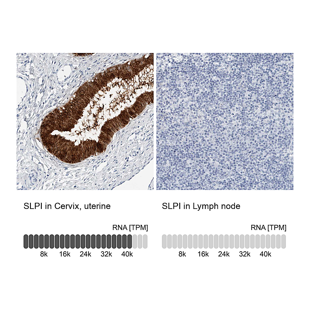 Atlas Antibodies Anti-SLPI Antibody