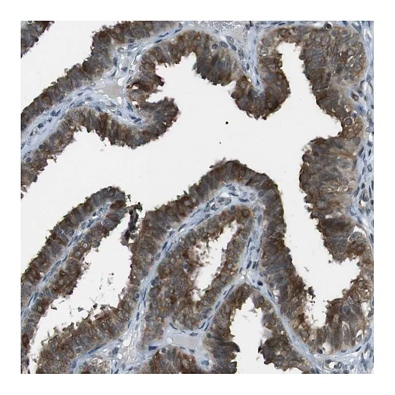 Atlas Antibodies Anti-SLITRK5 Antibody