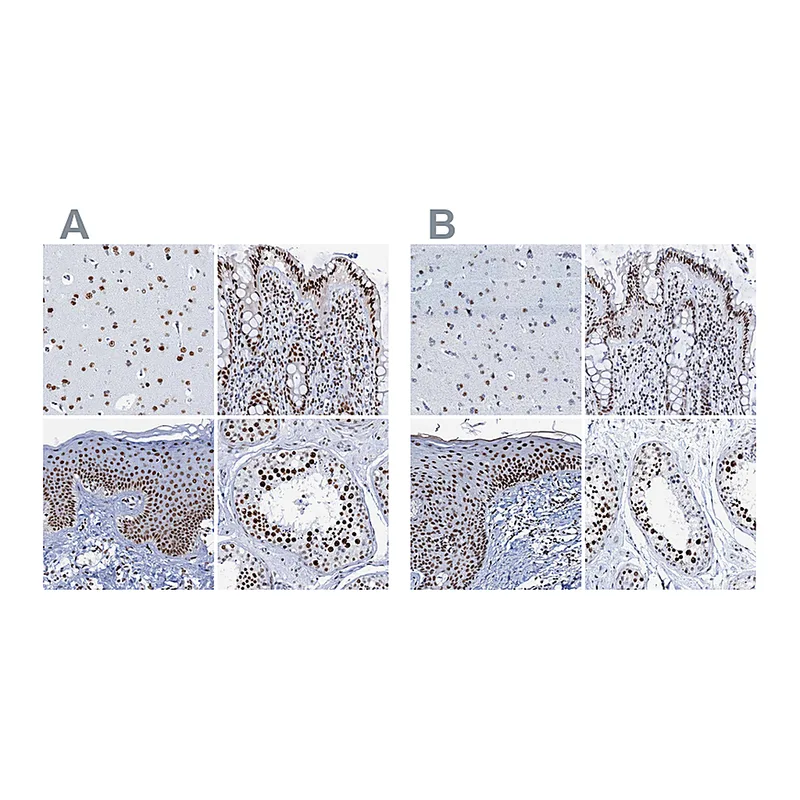 Atlas Antibodies Anti-SLTM Antibody