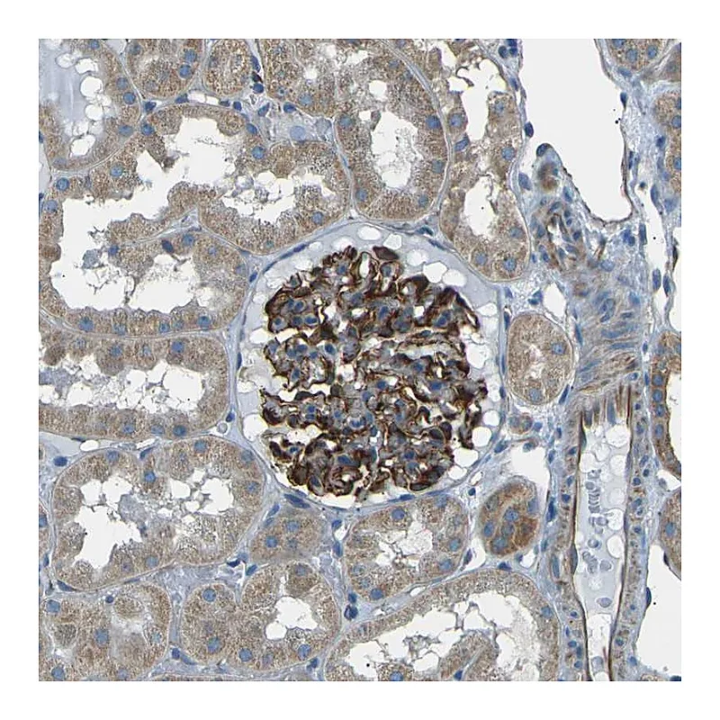 Atlas Antibodies Anti-SLK Antibody