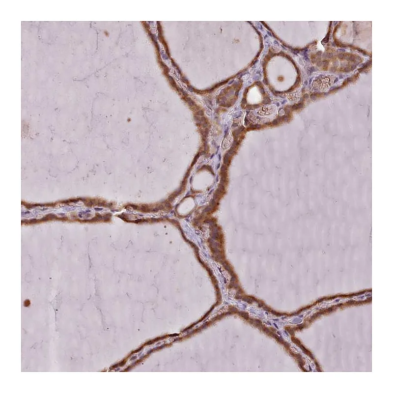 Atlas Antibodies Anti-SLX1A Antibody
