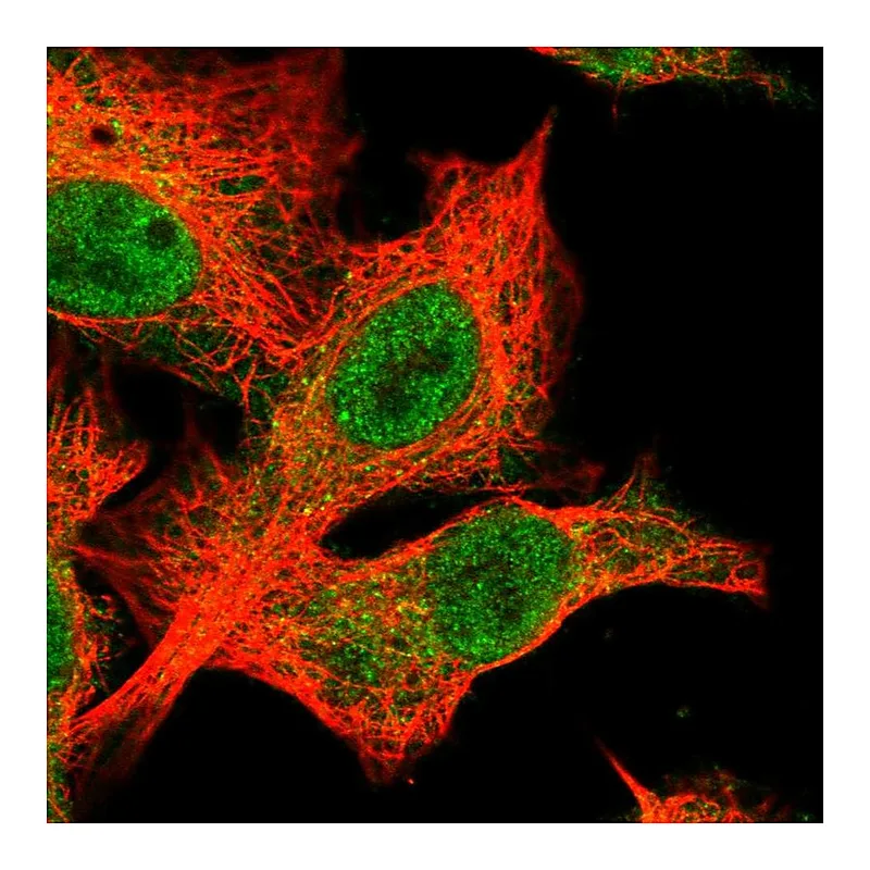 Atlas Antibodies Anti-SLX4 Antibody