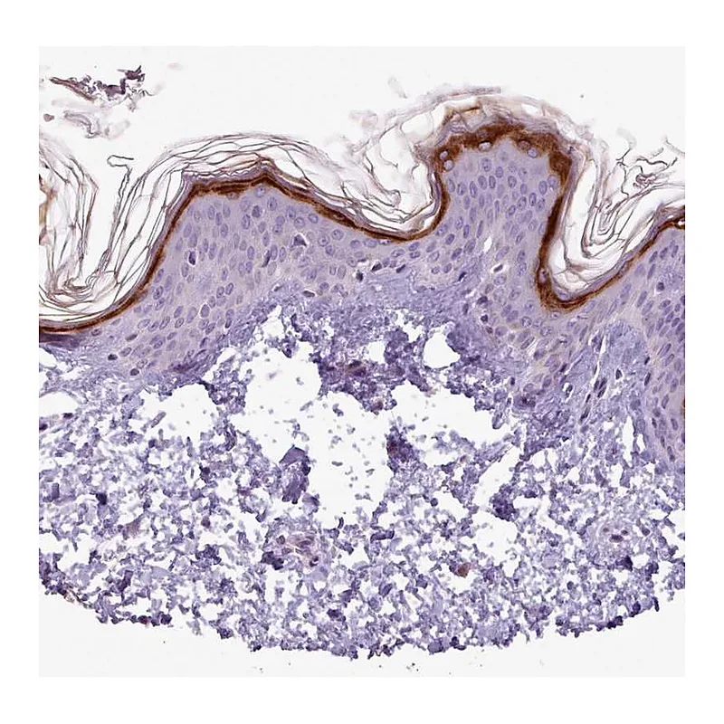 Atlas Antibodies Anti-SLURP1 Antibody