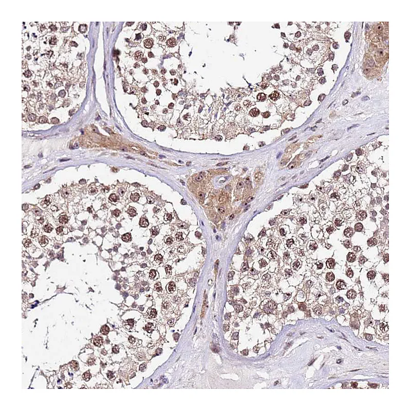 Atlas Antibodies Anti-SLX4IP Antibody