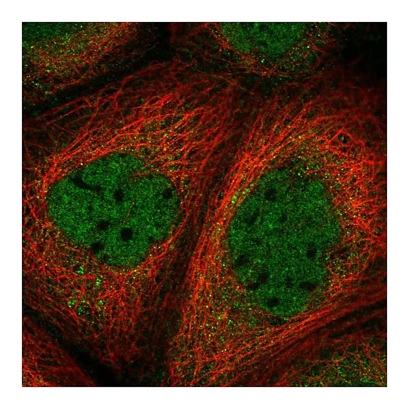 Atlas Antibodies Anti-SMAD3 Antibody
