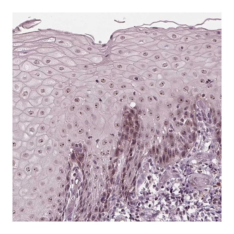 Atlas Antibodies Anti-SLX4 Antibody