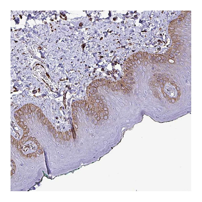 Atlas Antibodies Anti-SMAD5 Antibody