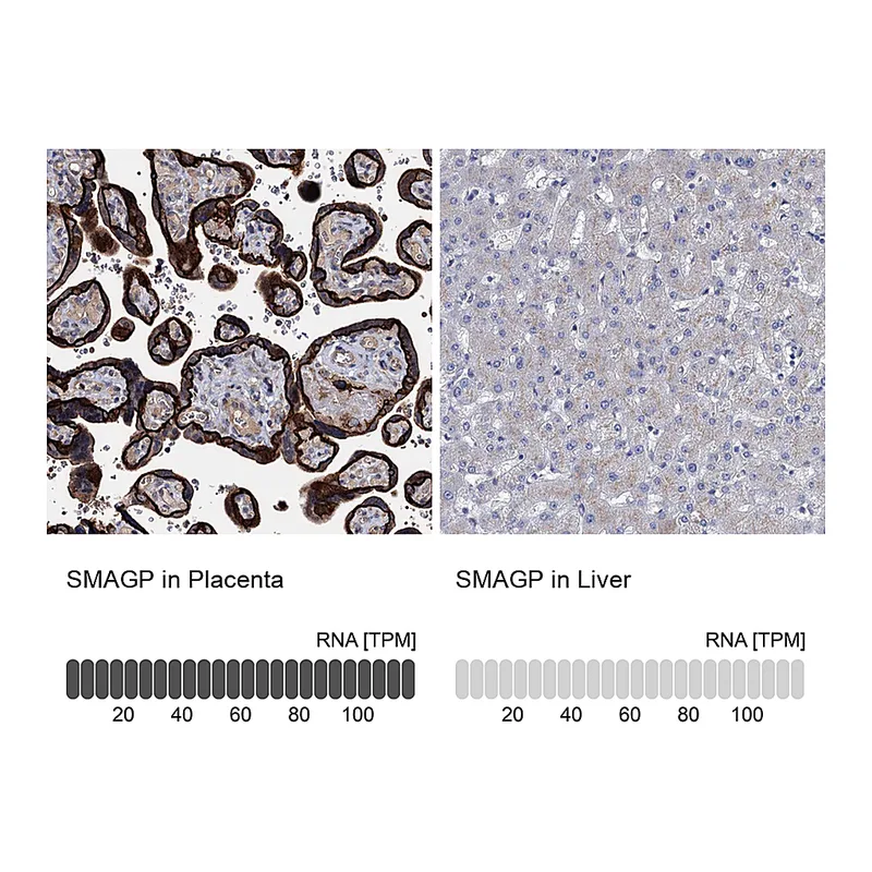 Atlas Antibodies Anti-SMAGP Antibody