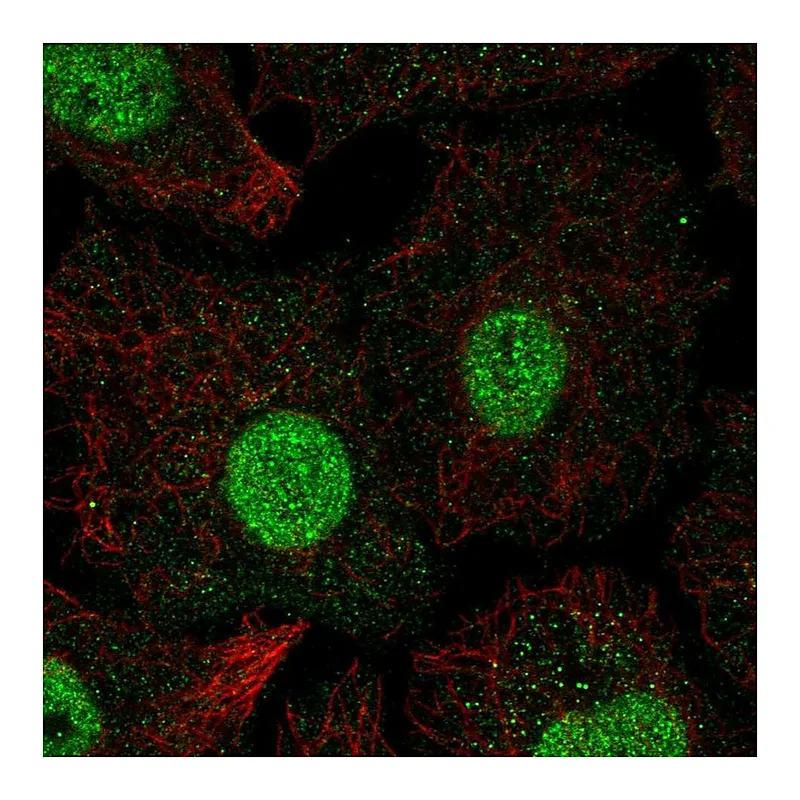 Atlas Antibodies Anti-SMAD6 Antibody