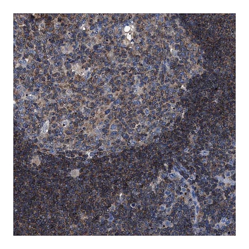 Atlas Antibodies Anti-SMAP2 Antibody