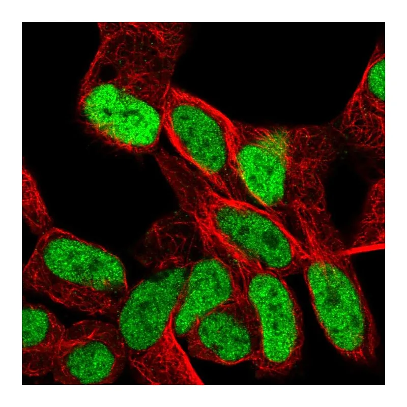 Atlas Antibodies Anti-SMARCA1 Antibody