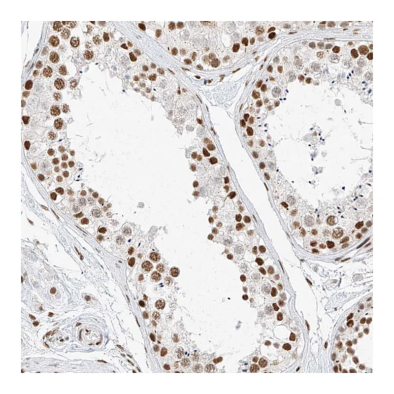 Atlas Antibodies Anti-SMARCA2 Antibody