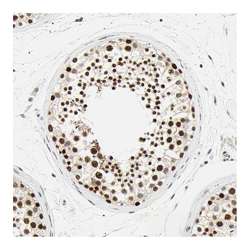 Atlas Antibodies Anti-SMARCA5 Antibody