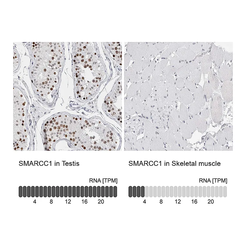 Atlas Antibodies Anti-SMARCC1 Antibody