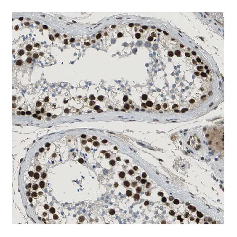 Atlas Antibodies Anti-SMARCAD1 Antibody