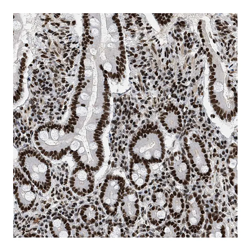 Atlas Antibodies Anti-SMARCB1 Antibody