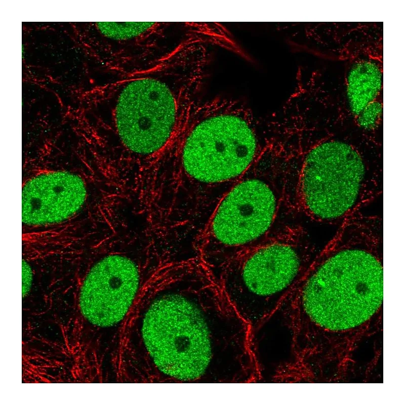 Atlas Antibodies Anti-SMARCC2 Antibody