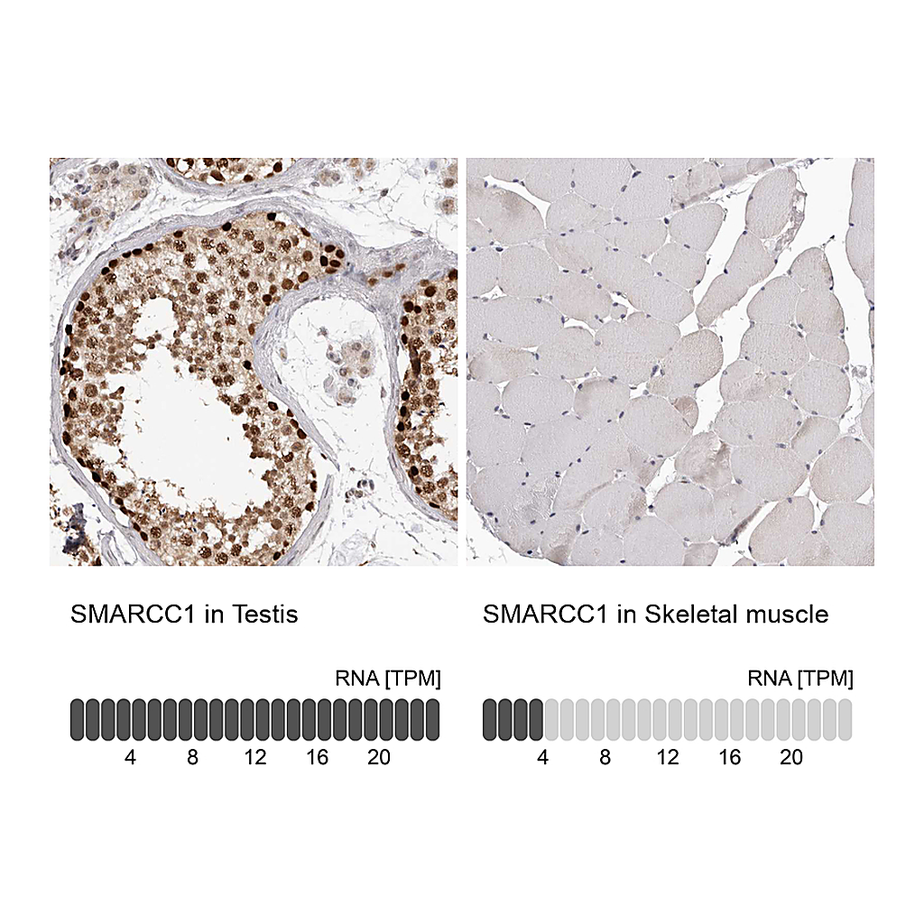 Atlas Antibodies Anti-SMARCC1 Antibody