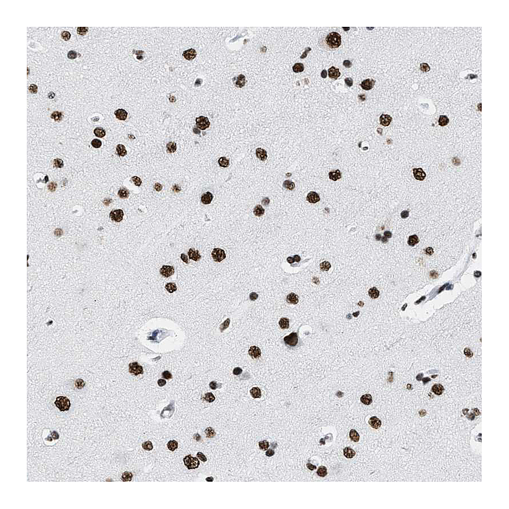 Atlas Antibodies Anti-SMARCC2 Antibody