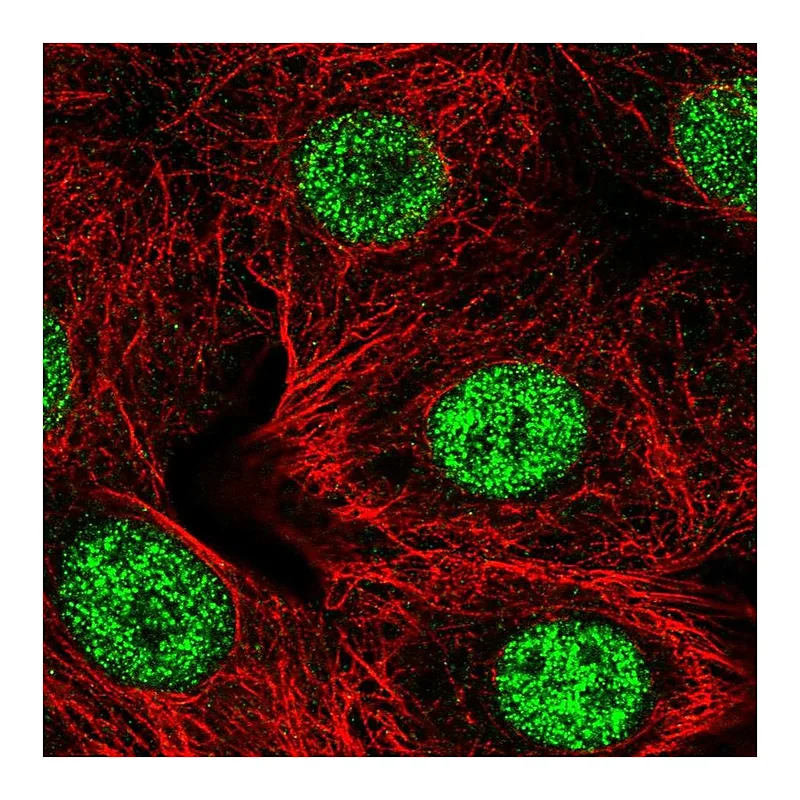 Atlas Antibodies Anti-SMARCD2 Antibody
