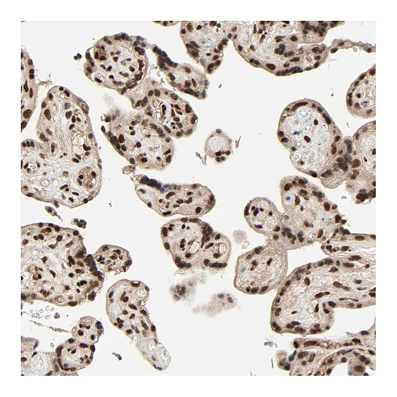 Atlas Antibodies Anti-SMARCD1 Antibody