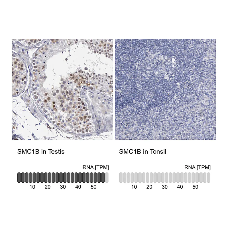 Atlas Antibodies Anti-SMC1B Antibody