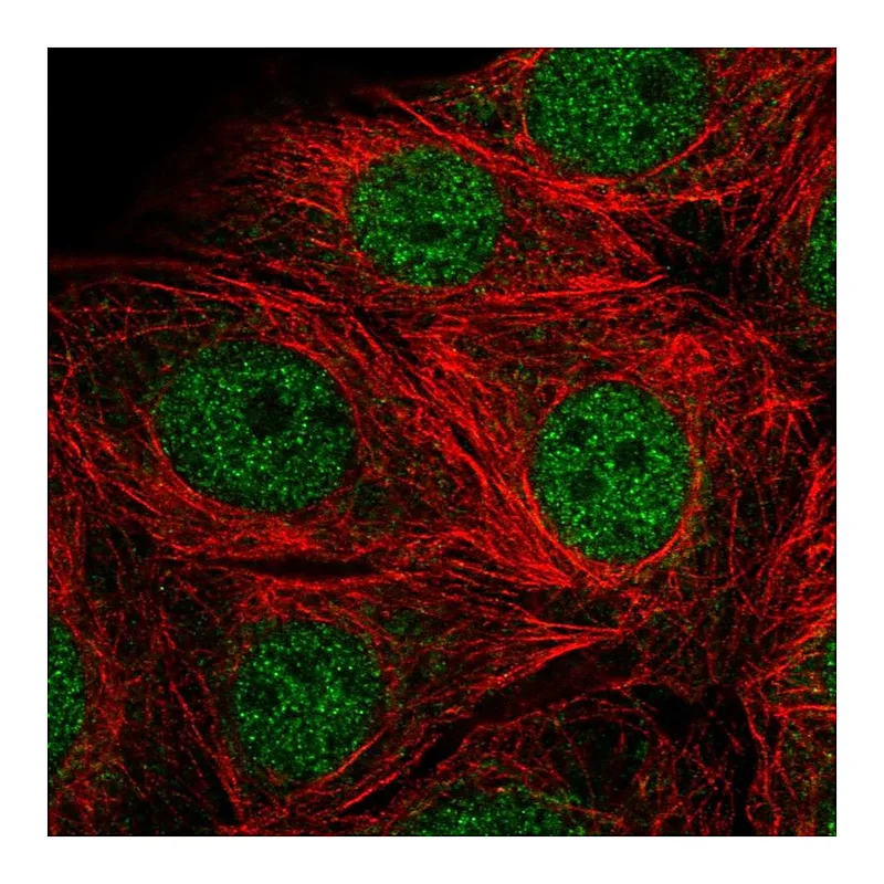 Atlas Antibodies Anti-SMARCD2 Antibody