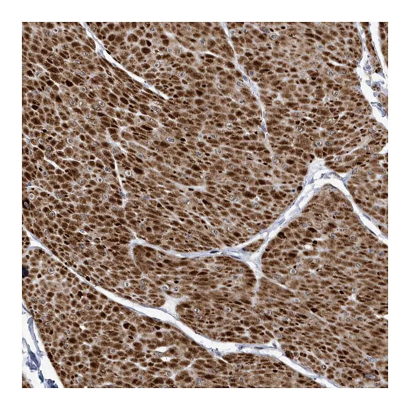 Atlas Antibodies Anti-SMC3 Antibody