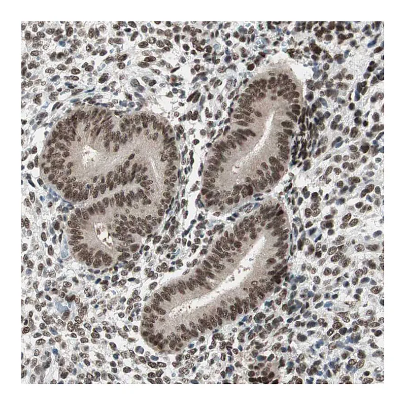Atlas Antibodies Anti-SMARCE1 Antibody