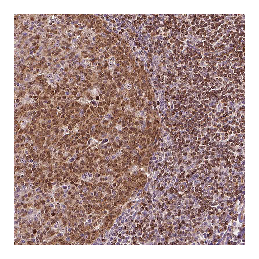 Atlas Antibodies Anti-SMC2 Antibody