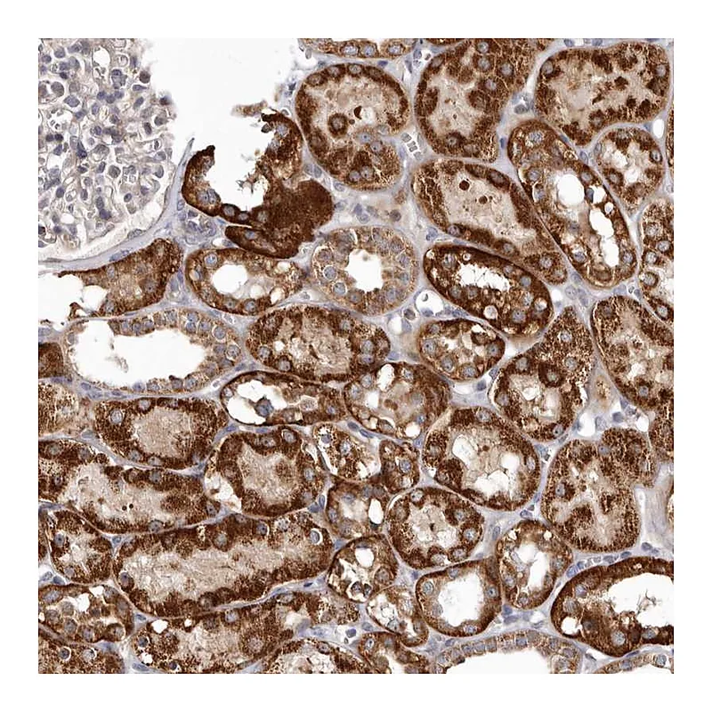 Atlas Antibodies Anti-SMC4 Antibody