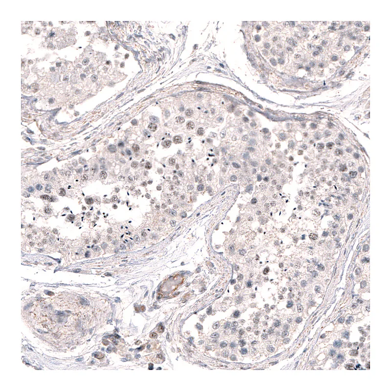 Atlas Antibodies Anti-SMC6 Antibody