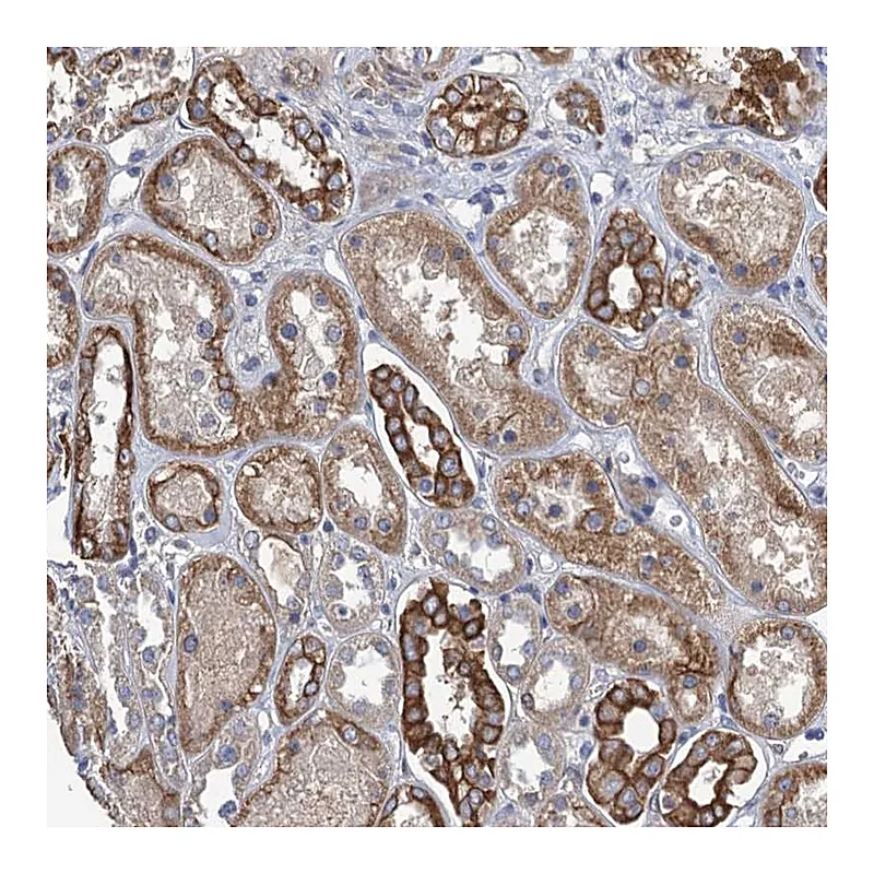 Atlas Antibodies Anti-SMCO3 Antibody