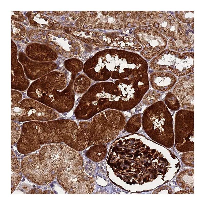 Atlas Antibodies Anti-SMCO3 Antibody