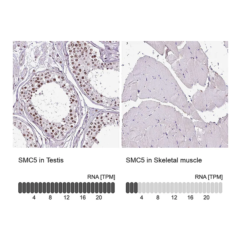 Atlas Antibodies Anti-SMC5 Antibody