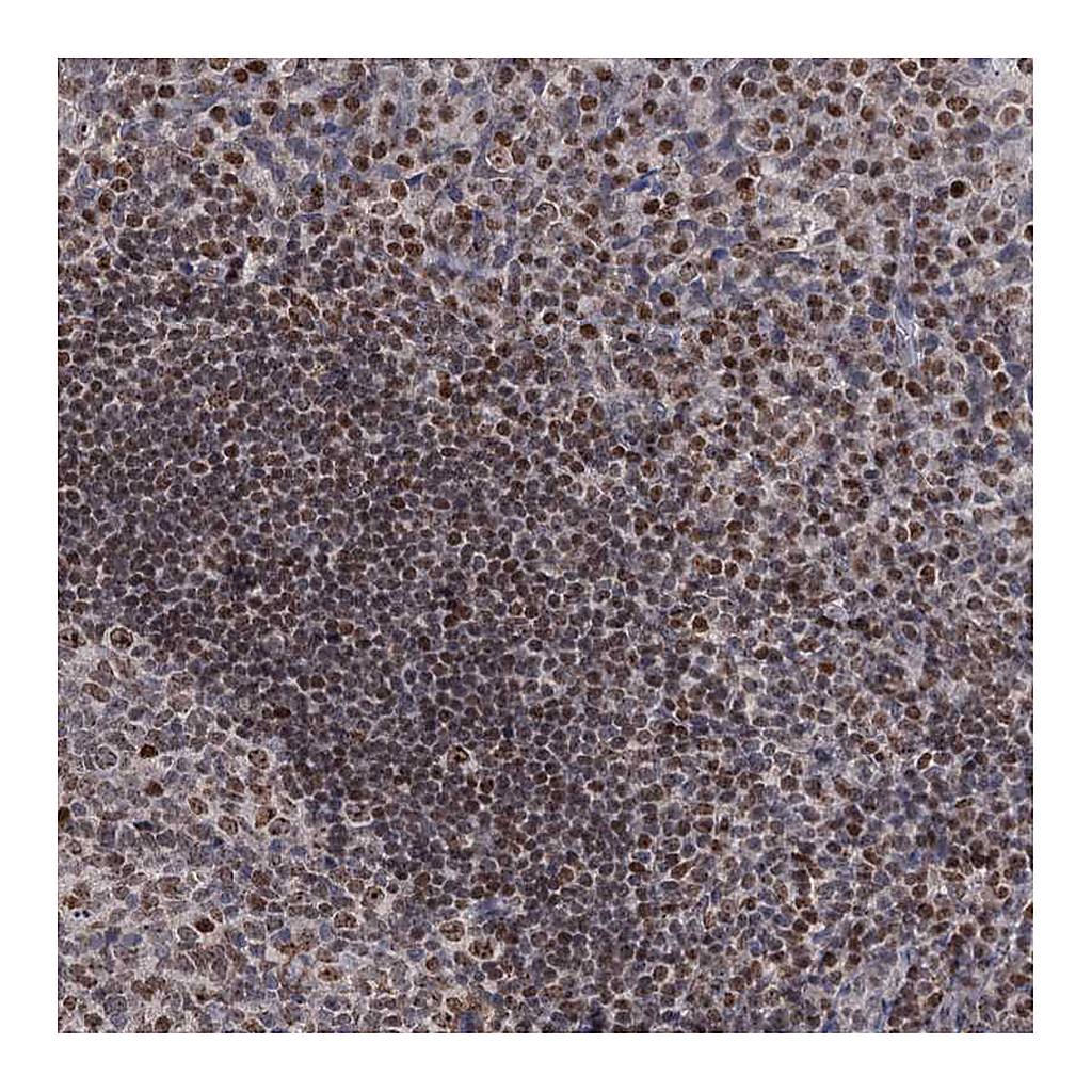 Atlas Antibodies Anti-SMCHD1 Antibody